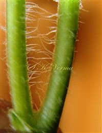  Stem